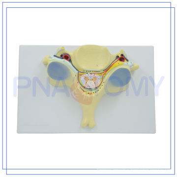 PNT-0614 7 times enlarged 5th cervical vertebrae model